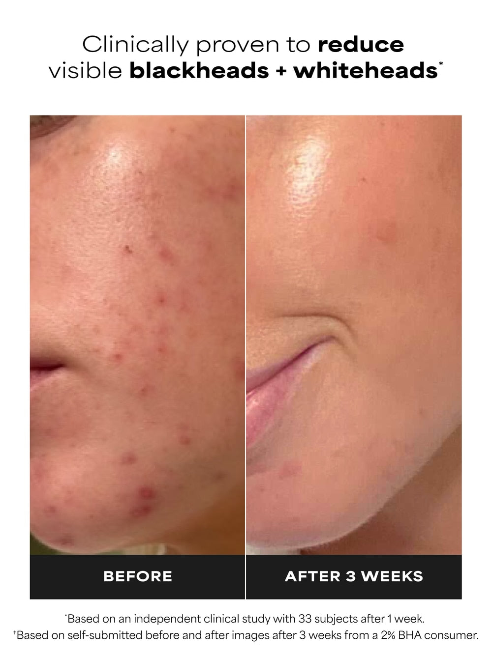 Paula’s Choice 2% BHA Liquid Exfoliant - 118ml