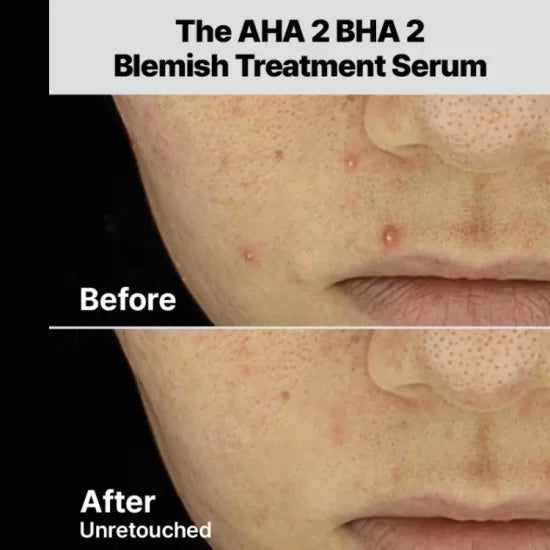 COSRX THE AHA 2 BHA 2 BLEMISH TREATMENT SERUM 50G