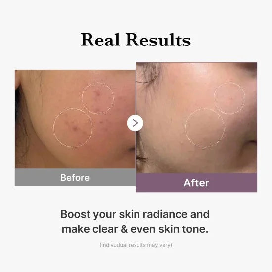 Medicube - AGE-R Glutathione Glow Toner 140ml