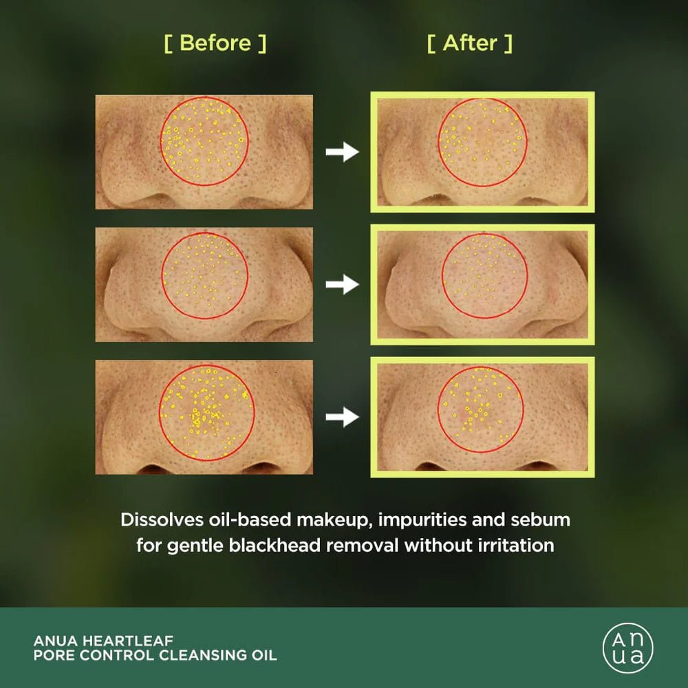 ANUA HEARTLEAF+VITAMIN E PORE CONTROL CLEASING OI