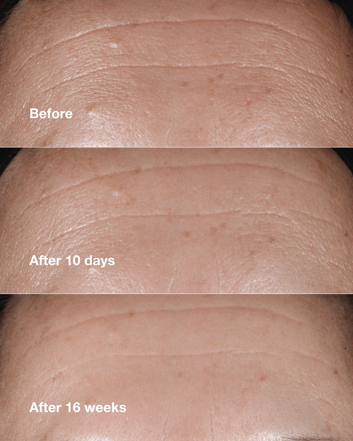 CLINIQUE WRINKLE CORRECTING SERUM