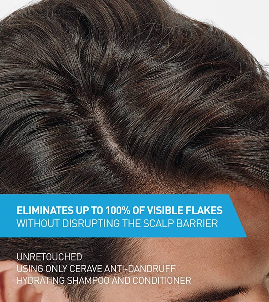 CERAVE ANTI DANDRUFF ANTIPLLICULAIF